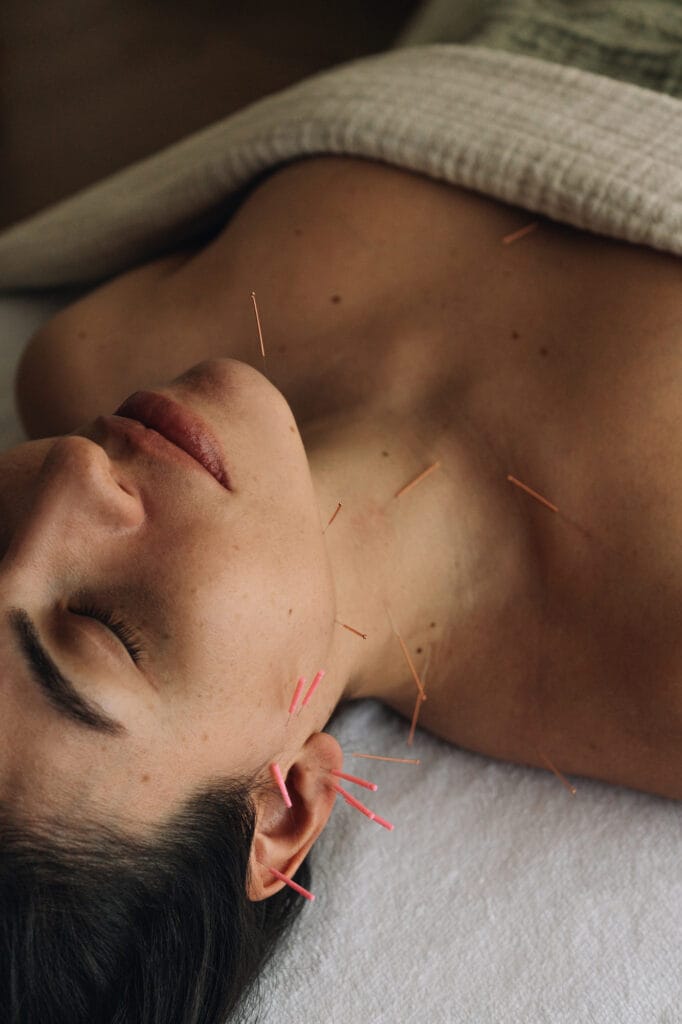 Cosmetic acupuncture