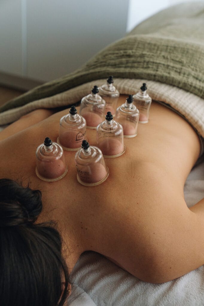 Therapeutic body cupping